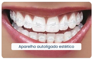 Aparelho_Autoligado-Estético