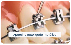 Aparelho-Autoligado-Metalico