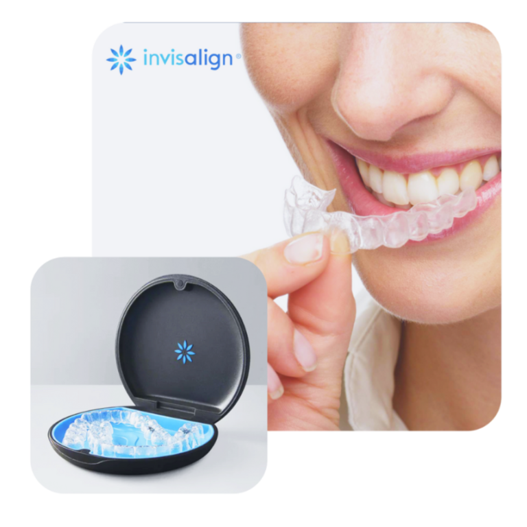 Invisalign,Trinity Odontologia Integrada